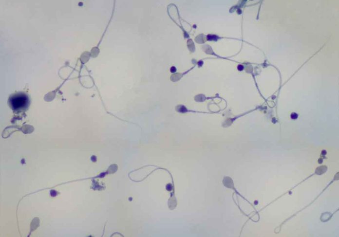 Concerning Pattern Found in Sperm Count Among Men