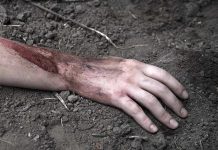 Injured arm partially buried in dirt.
