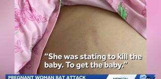 Pregnant woman attacked with bat while leaving work in