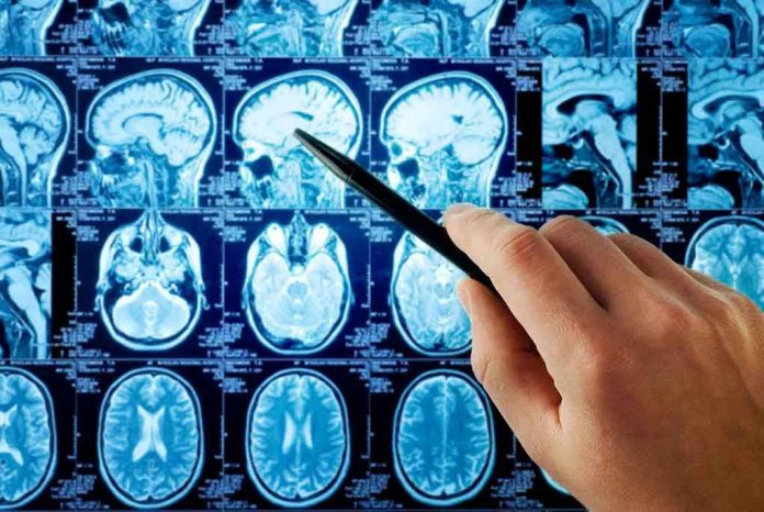 Hand pointing at brain scan images on screen.