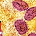 NIH Lab Scandal: Monkeypox At The Airport?