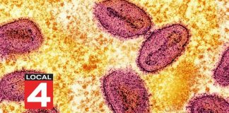NIH Lab Scandal: Monkeypox At The Airport?
