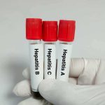 Gloved hand holding three blood sample tubes with red caps